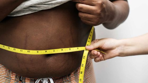 L’obésité : personne n’est à l’abri