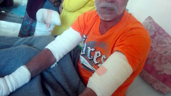 Le soir de ses 47 ans : Pradeep pris au piège des flammes