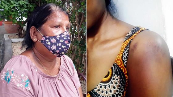 Violence envers les femmes : il agresse son ex-épouse et sa mère, la veille de Divali, devant sa fillette