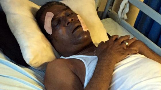 À Pointe-Aux-Sables : un vigile de 65 ans roué de coups 