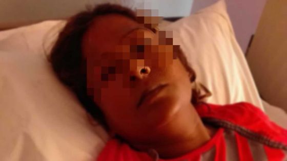 Arrêté pour incendie criminel : vingt ans de calvaire auprès d’un mari toxicomane