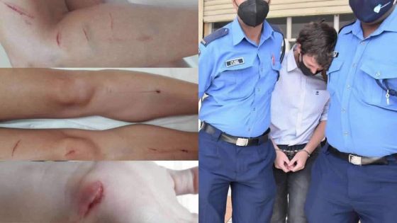 Gregory Suntah : «Je ne l’ai pas torturée, elle s’est mutilée»