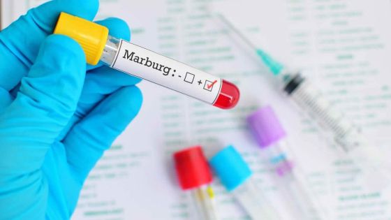 Détection dans deux pays africains : ce qu’il faut savoir sur le virus de Marburg