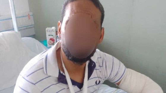 Recherché depuis deux ans et demi pour trafic d’héroïne : un Seychellois aux identités multiples démasqué