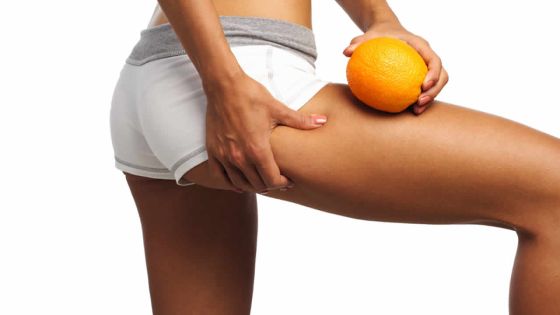 Cellulite : faites-lui la peau !