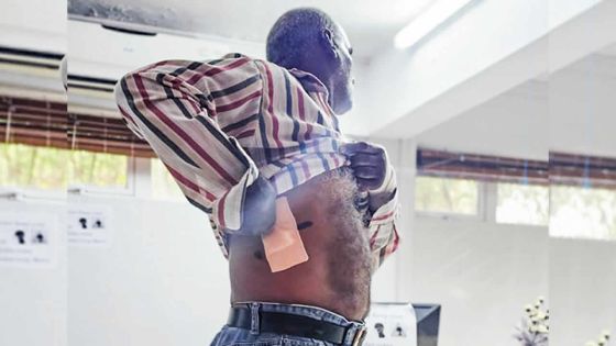 Agression : un homme est poignardé par un invité lors d’un mariage