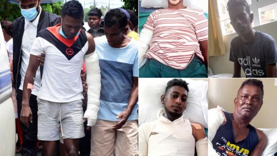 Six victimes à la Burns Unit : une tragédie gravée dans la chair 