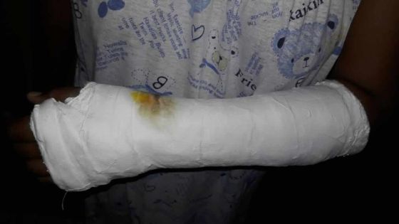 Salle de gym à Quatre-Bornes : gravement blessée, elle déplore «l’insensibilité» du coach