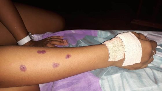 Rose-Hill : une collégienne blessée après que la vitre d’un bus a volé en éclats ; les travaux du Metro Express montrés du doigt