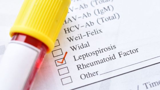 Transférée à Maurice pour des problèmes hépatiques : une Rodriguaise de 58 ans testée positive à la leptospirose