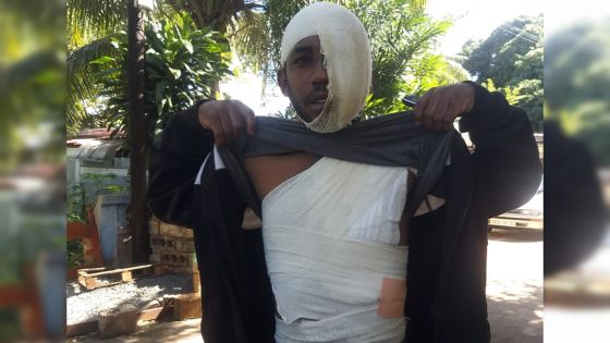 Violence domestique : un homme de 25 ans ébouillanté par son ex-concubine