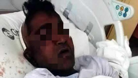 Bagarre sanglante dans le port : tabassé par des marins chinois, il se retrouve à l’ICU