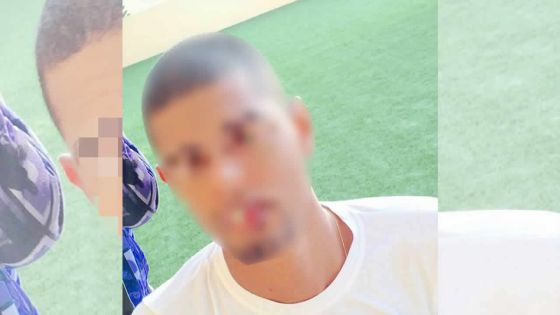 À Moka : le directeur d’un centre d’appels tabassé par quatre hommes encagoulés 