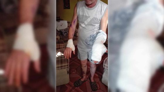 Tentative de vol : un Belge agressé au couteau dans sa cour