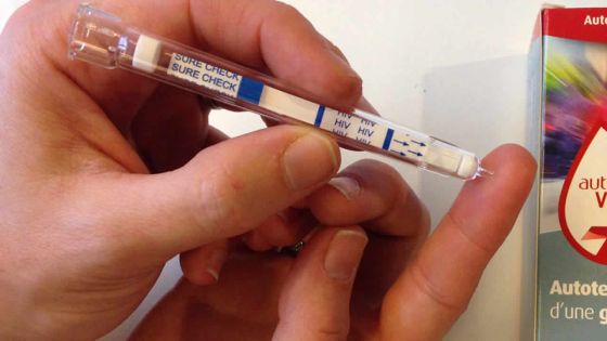 Le nombre de cas de VIH de nouveau en hausse