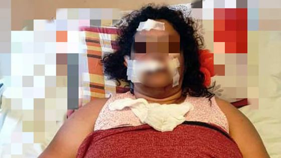 Sur un arrêt d’autobus à Sainte-Croix : un mari jaloux taillade le visage de sa femme