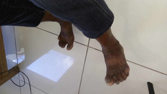 À l’hôpital Dr A.G Jeetoo : admis pour une égratignure, il meurt d’une septicémie