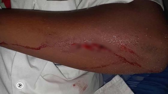 Bousculade entre collégiens : le petit Ezéchiel, 11 ans, livré à lui-même 