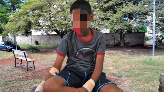 La Tour Koënig : un singe attaque un garçonnet de 10 ans