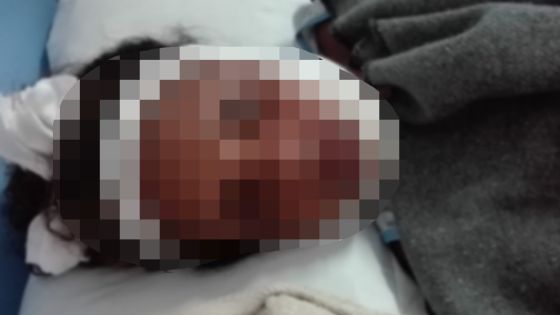 Violée alors qu'elle se prostituait : le calvaire de Kelly devenue junkie