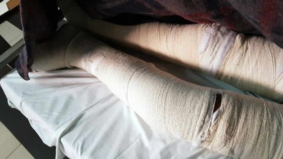 Course automobile à Lapipe, Dubreuil : fracture du pied, du genou et du bassin d’un spectateur de 16 ans