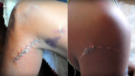 Wendy : «Ils nous ont agressés pour une histoire de drogue»