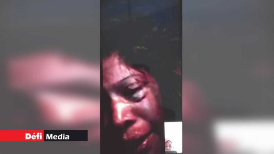 Filmée en train de se faire agresser par son époux : elle regrette d’avoir retiré sa plainte