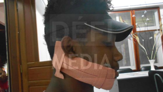 Pailles : un jeune défigure son ami d’enfance