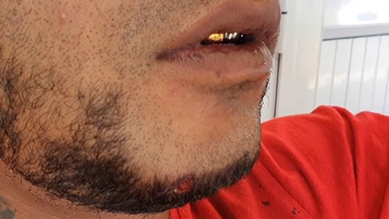 À Résidence Barkly : François Gowin, 28 ans, touché par balle