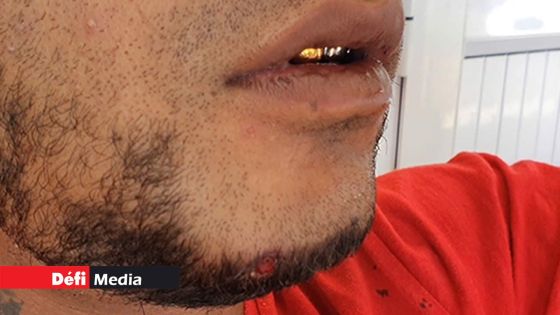 Touché par balle à Barkly : François Gowin a pu quitter l’hôpital 