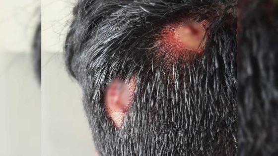 Dans un établissement à New-Grove : un collégien opéré après avoir été agressé par un autre 