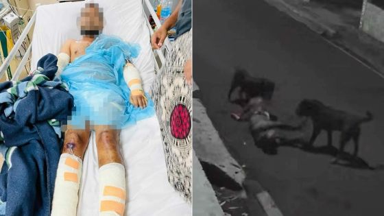 Attaque sauvage par deux rottweilers en pleine rue, dimanche soir : la victime a peu de chances de recouvrer l’usage de son bras droit