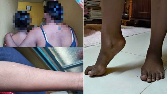 Se disant victime de « bullying » de la part de son enseignant : une écolière de 12 ans tente de se suicider à deux reprises