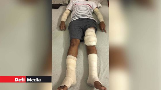 Quatre mois après avoir attaqué un homme à Port-Louis : les deux rottweilers restent introuvables