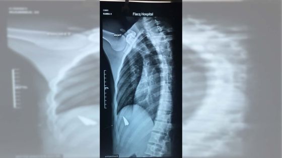 Gangs rivaux en milieu scolaire : un élève agressé au cutter par un autre 