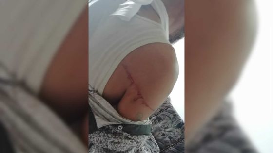 À Plaine-Verte : un chauffeur de bus blessé pris en chasse par son agresseur