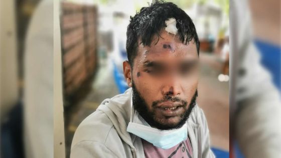 Amit agressé avec un pied-de-biche : «J’ai pensé que ma dernière heure était arrivée»