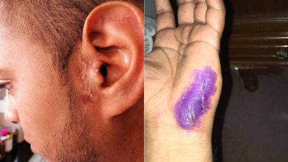 Agression au sabre : un jeune piégé par une « femme » connue sur Messenger 