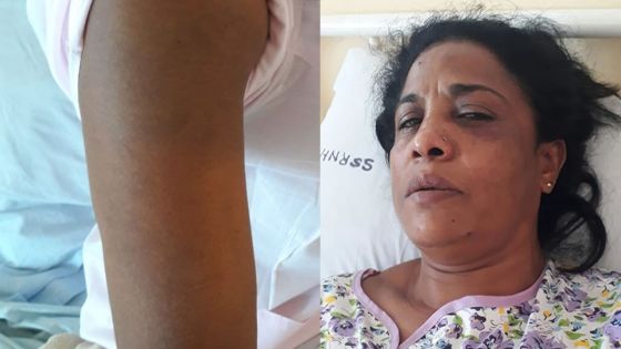 Une femme de 45 ans agressée à coups de casque - La fille de la victime : «Linn tromatize, linn gagn enn sok»
