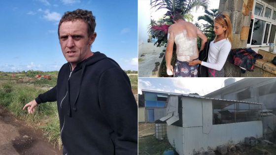 À Saint-François : un promeneur attaqué par des pitbulls et des rottweillers