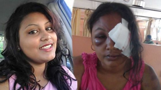 Acte de barbarie : il sévit contre son épouse enceinte