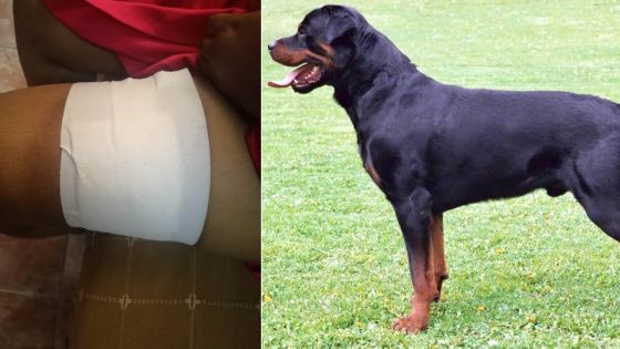 En se rendant à une boutique : une jeune femme attaquée par un chien de race