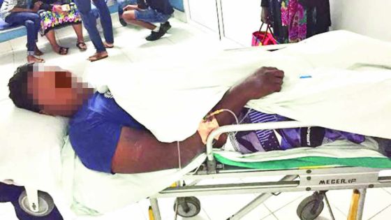 Accident à Bras-d’Eau : un homme de 23 ans amputé du pied droit