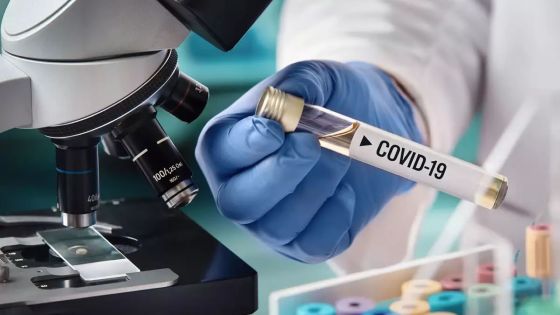 En gestation : création à Maurice d’un centre de production de tests kits de la Covid-19