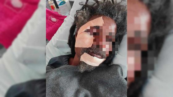 Nuit de terreur à Stanley : un homme agressé au sabre en protégeant son neveu