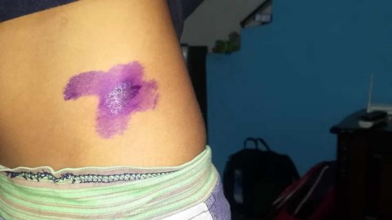 Dans une école primaire de Port-Louis : un parent déplore un manque de sécurité et d’encadrement