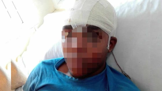 Après un match de foot : un ado agressé à coups de brique à la tête