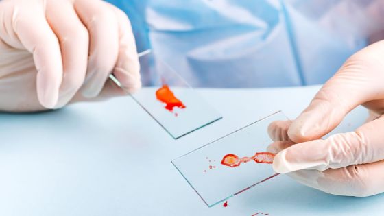  Coronavirus : deux enfants d'un et cinq ans contaminés dans l'est de la France