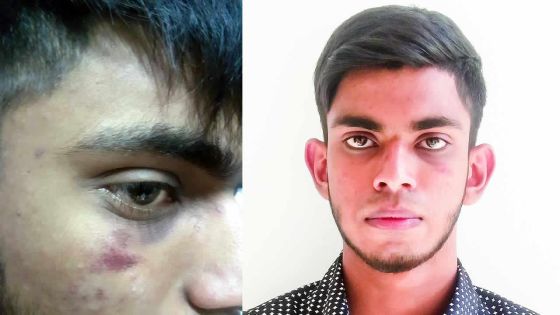 Rallye «illégal» à Terre-Rouge : arrêté, il nie avoir participé à une «course» et dit avoir été «brutalisé»