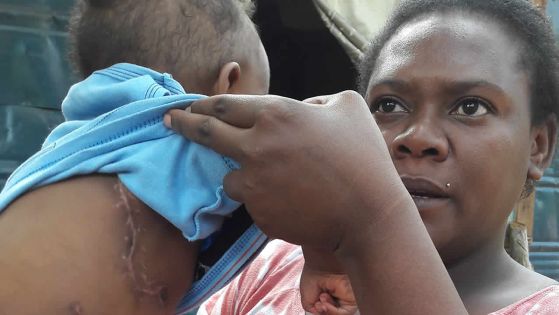 Élevage de porc illégal à Riche-Terre: un enfant d’un an infecté au poumon